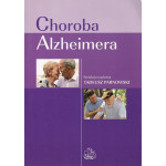 Choroba Alzheimera