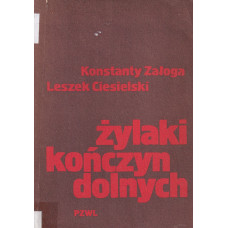 Żylaki kończyn dolnych Żylaki kończyn dolnych
