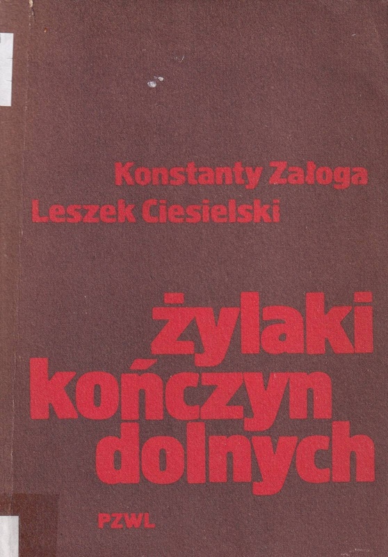 Żylaki kończyn dolnych