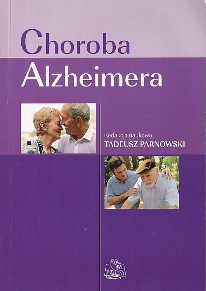 Choroba Alzheimera